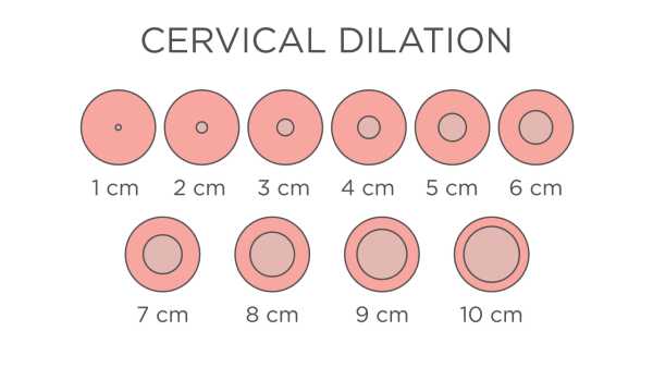 Cervical Dialation Chart