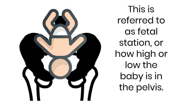 fetal station reference photo