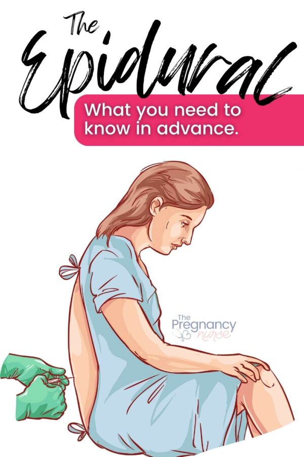 The epidural - what you need to know in advance // woman getting an epidural.