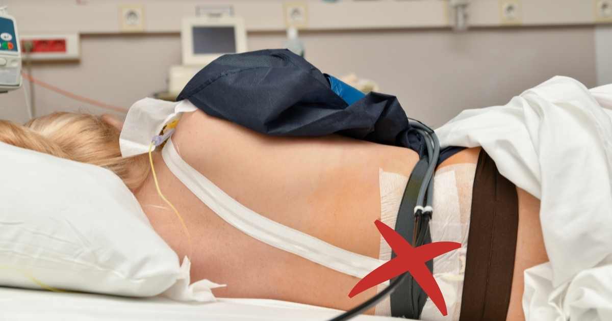 woman with an epidural
