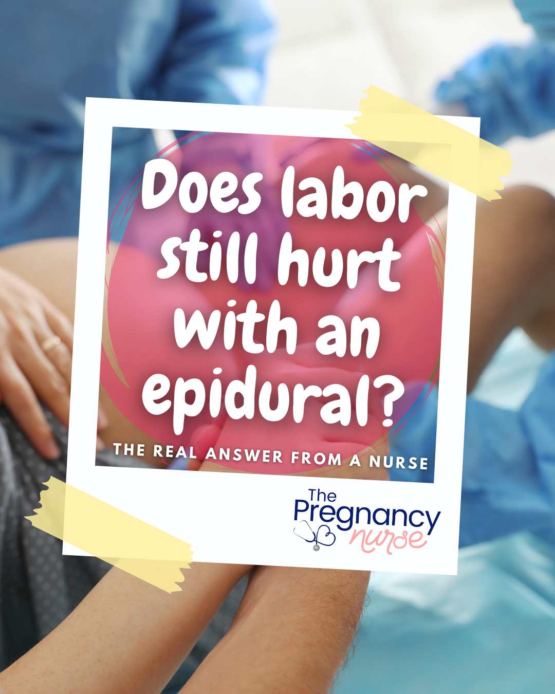 how much pain will I feel with the epidural?