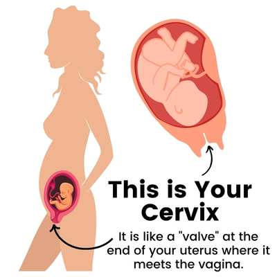pictures of what/where a cervix is -- it's like a "valve" at the end of your uterus where it meets the vagina