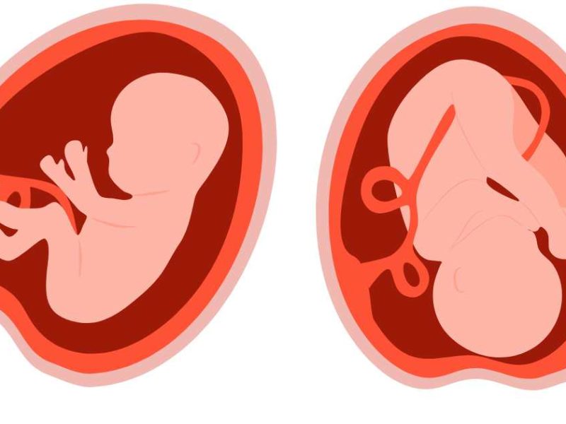 baby in different womb positions