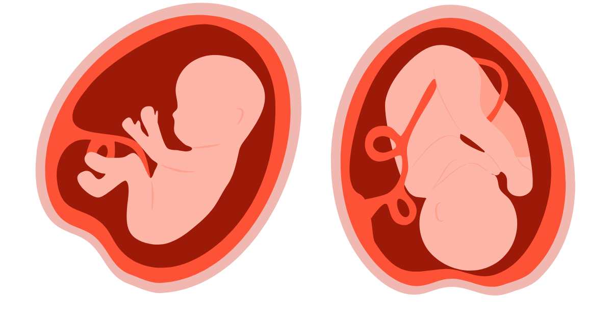 baby in different womb positions