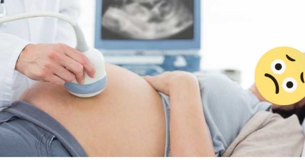 pregnancy ultrasound