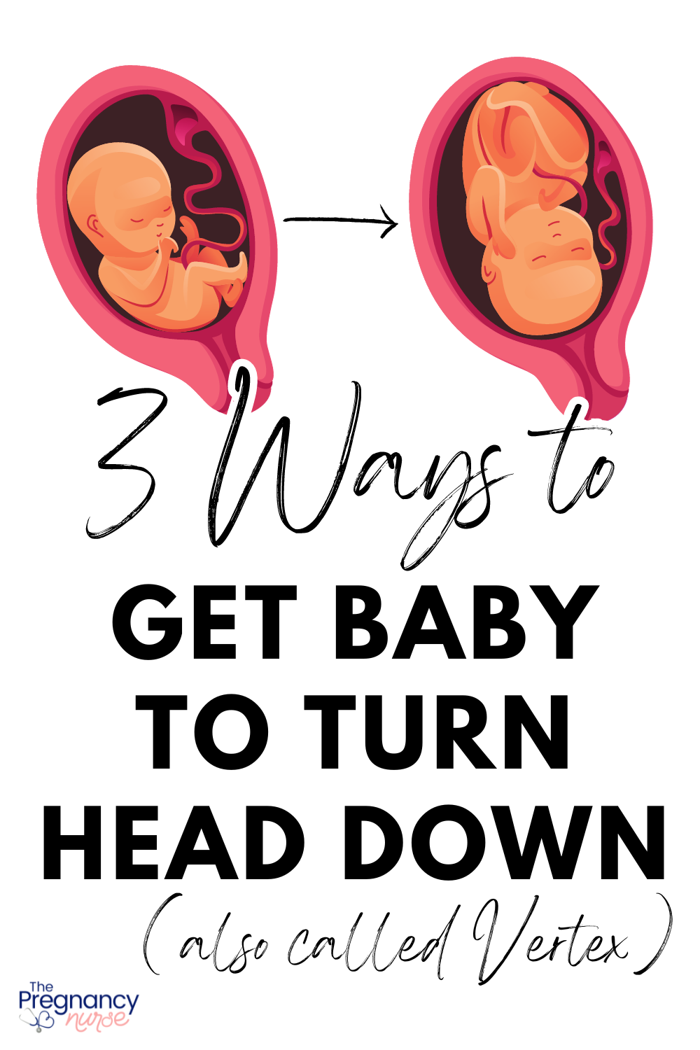fetus bum down, and then head down. 3 ways to get baby to turn head down (also called vertex).