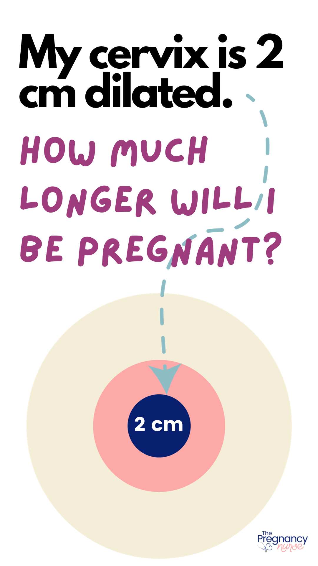 I m 2 Cm Dilated How Much Longer The Pregnancy Nurse 
