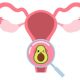 uterus, with an avocado over the cervix in a magnifying glass
