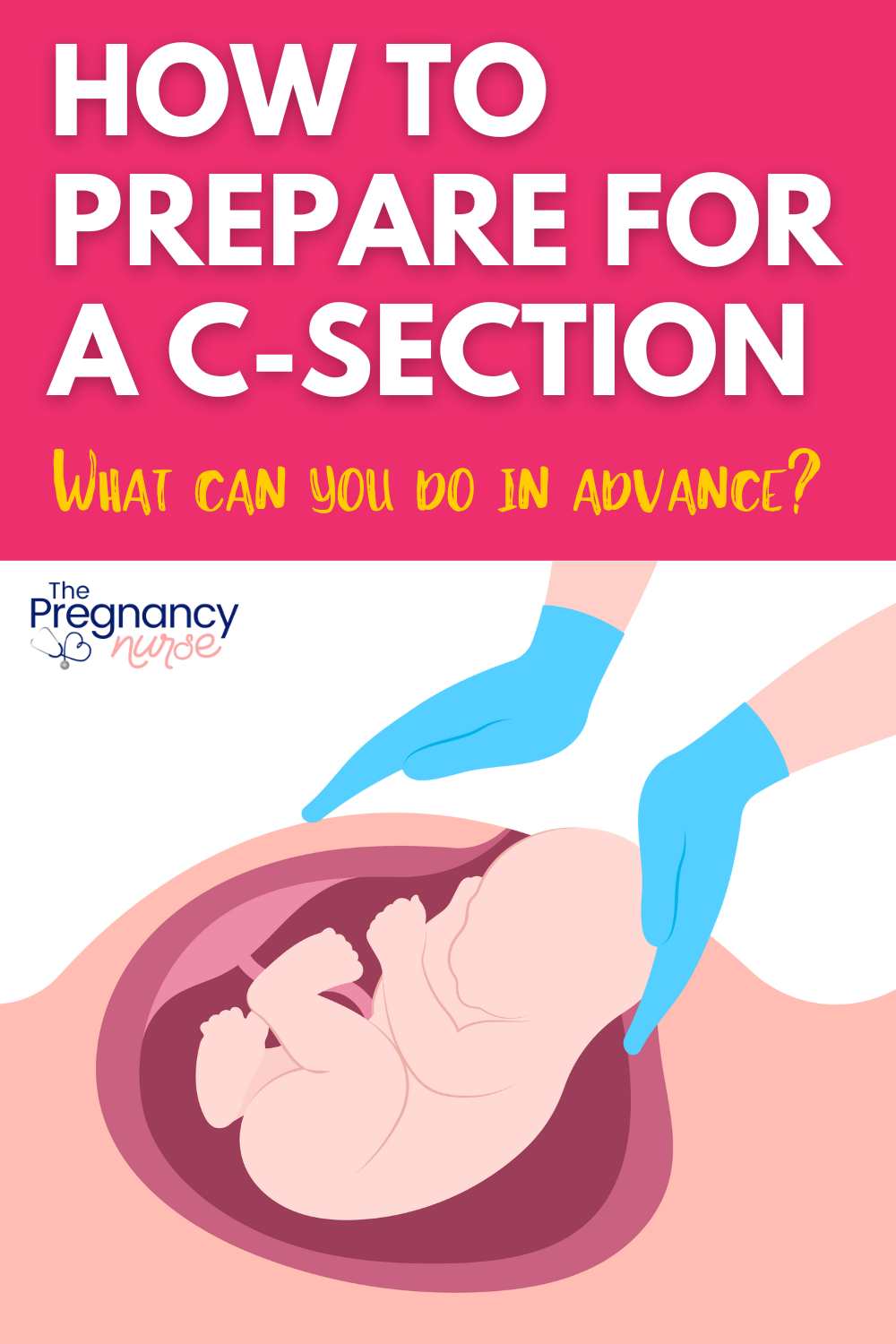 "Embark on a well-prepared journey for your upcoming C-section with our comprehensive guide. From crafting a detailed birth plan to understanding the nuances of recovery, we've curated expert advice to ensure you feel confident and ready. Pin this invaluable resource for a smooth and stress-free C-section experience. Explore essential tips and insights to make your motherhood journey truly special. #CSectionPreparation #BirthPlan #MotherhoodTips #CSectionGuide #PregnancyJourney"