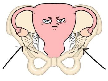 uterus in a pelvis with round liagments