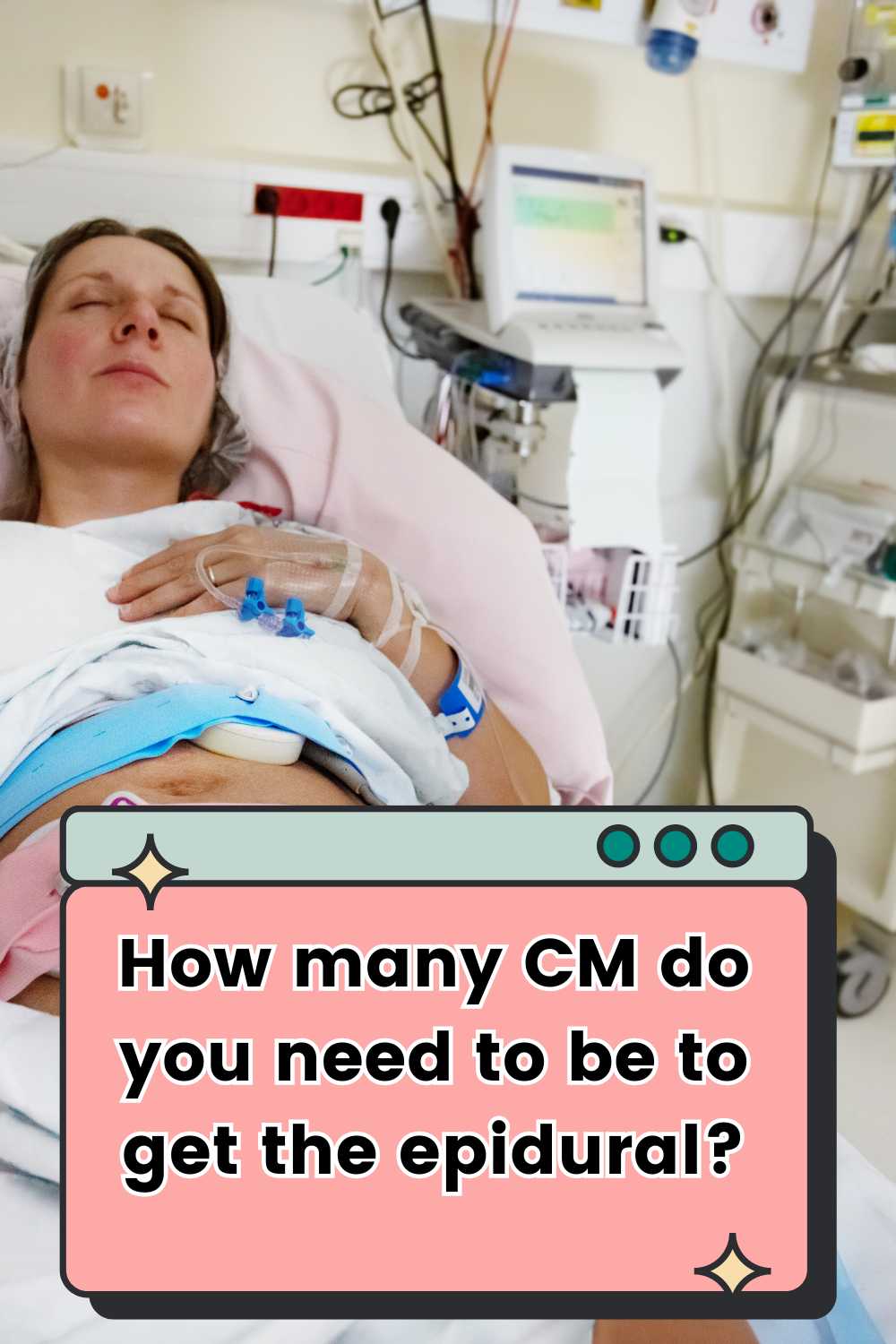 How Many CM Do You Need to Be to Get An Epidural?