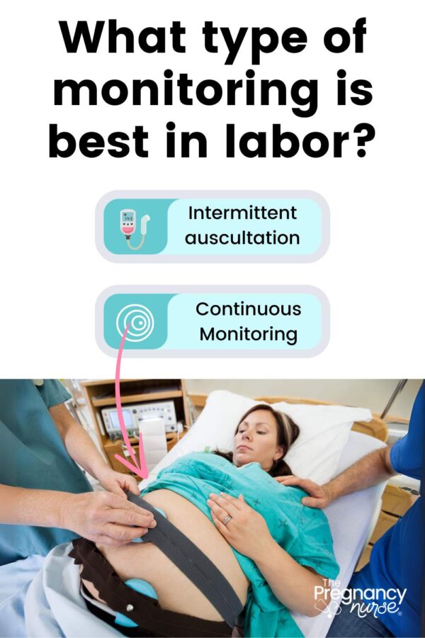 what type of monitoring is best in labor // intermittent auscultation vs continuous monitoring -- image of continuous fetal monitoring in use.
