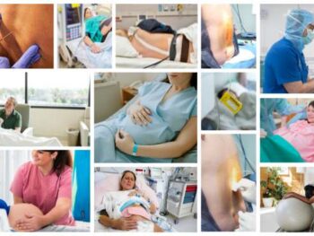 many images of a pregnant woman in the hospital getting an epidural