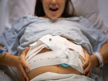 pregnant woman with fetal monitors on